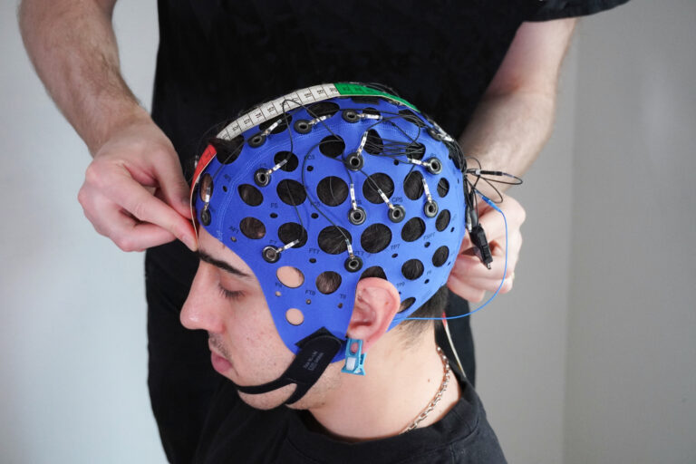 Mastering the 10-20 System for Accurate EEG Electrode Placement
